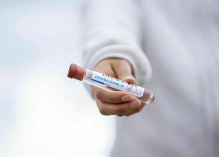 ШЫМКЕНТТЕ ЭПИДАХУАЛ КҮРДЕЛІ