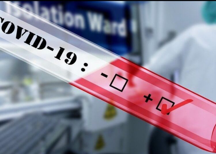 ӨТКЕН ТӘУЛІКТЕ 157 АДАМНАН КОРОНАВИРУС АНЫҚТАЛДЫ